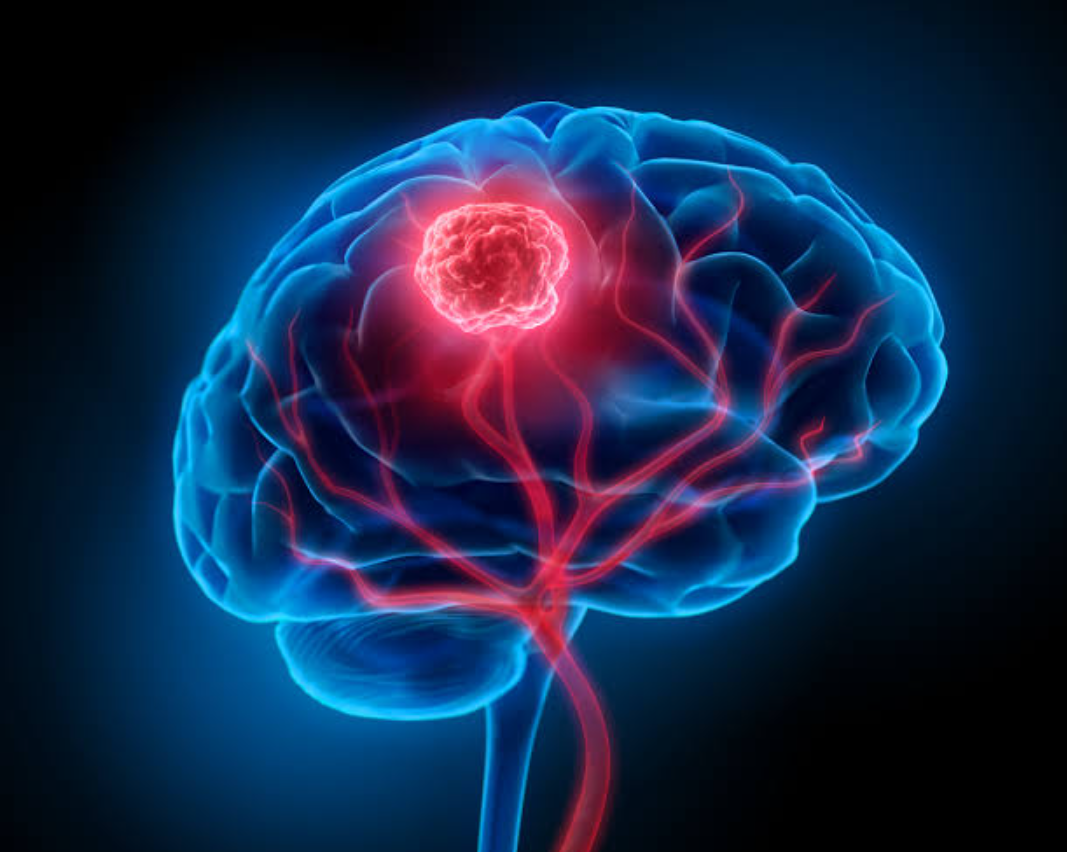 WHAT ARE COMMON SYMPTOMS OF CANCERS (CANCER DAY SPECIAL) : SUNDAY MIRROR